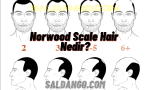 Norwood Scale Hair Nedir