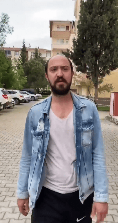 Screenshot 5 22 yaşında kel kalmış bir genç: Oğuzhan Alpdoğan